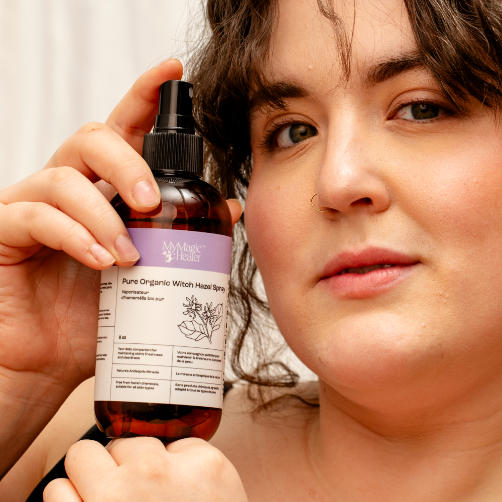 Boils, HS & Razor Bumps Witch Hazel Spray | MyMagicHealer