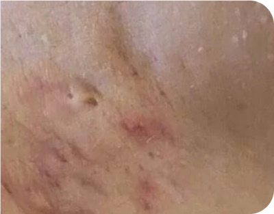 2. Tunnels - after 2. Tunnels - after