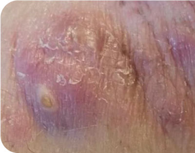 2. Tunnels - before 2. Tunnels - before