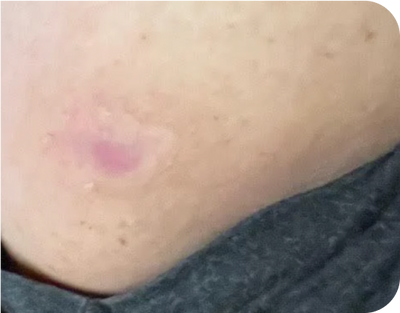 7. Open Sores - after 7. Open Sores - after