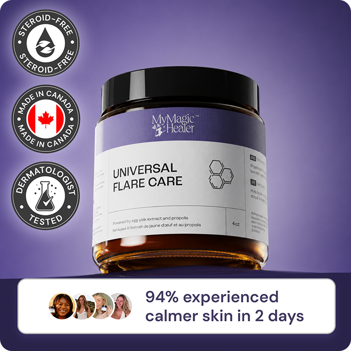 Universal Flare Care ------ V1