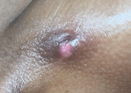 Stage 2 – Calms Stage 2 – Calms