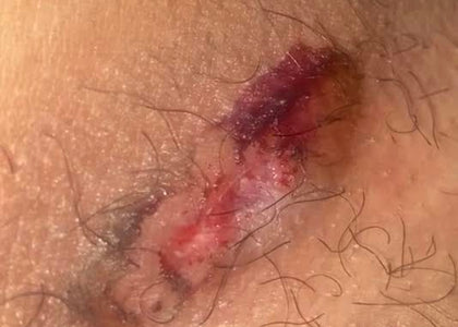 Stage 2 – Calms Stage 2 – Calms