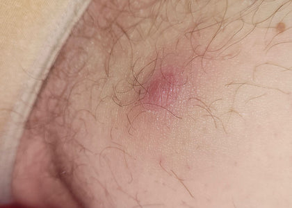 Stage 2 – Calms Stage 2 – Calms