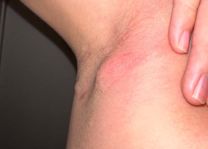 Stage 1 – Relieves Pain Stage 1 – Relieves Pain