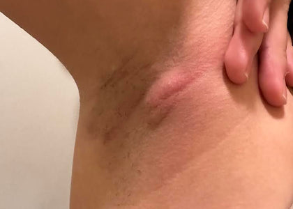 Stage 2 – Calms Stage 2 – Calms