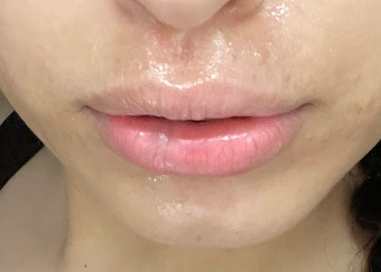 Stage 3 – Protects Stage 3 – Protects