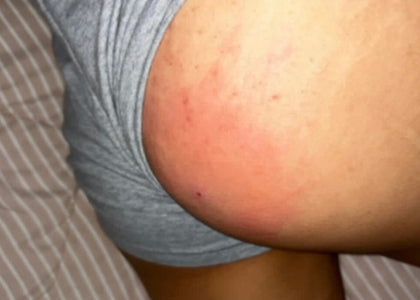Stage 1 – Relieves Pain Stage 1 – Relieves Pain