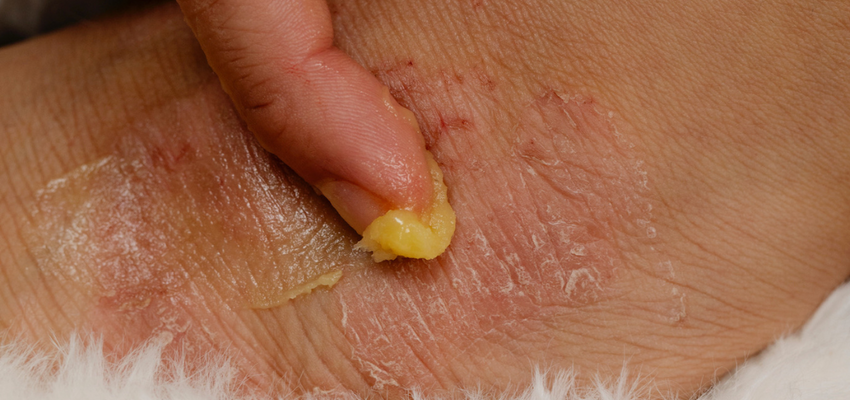 Universal Skin Healer