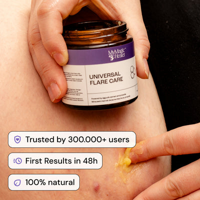 Universal Flare Care