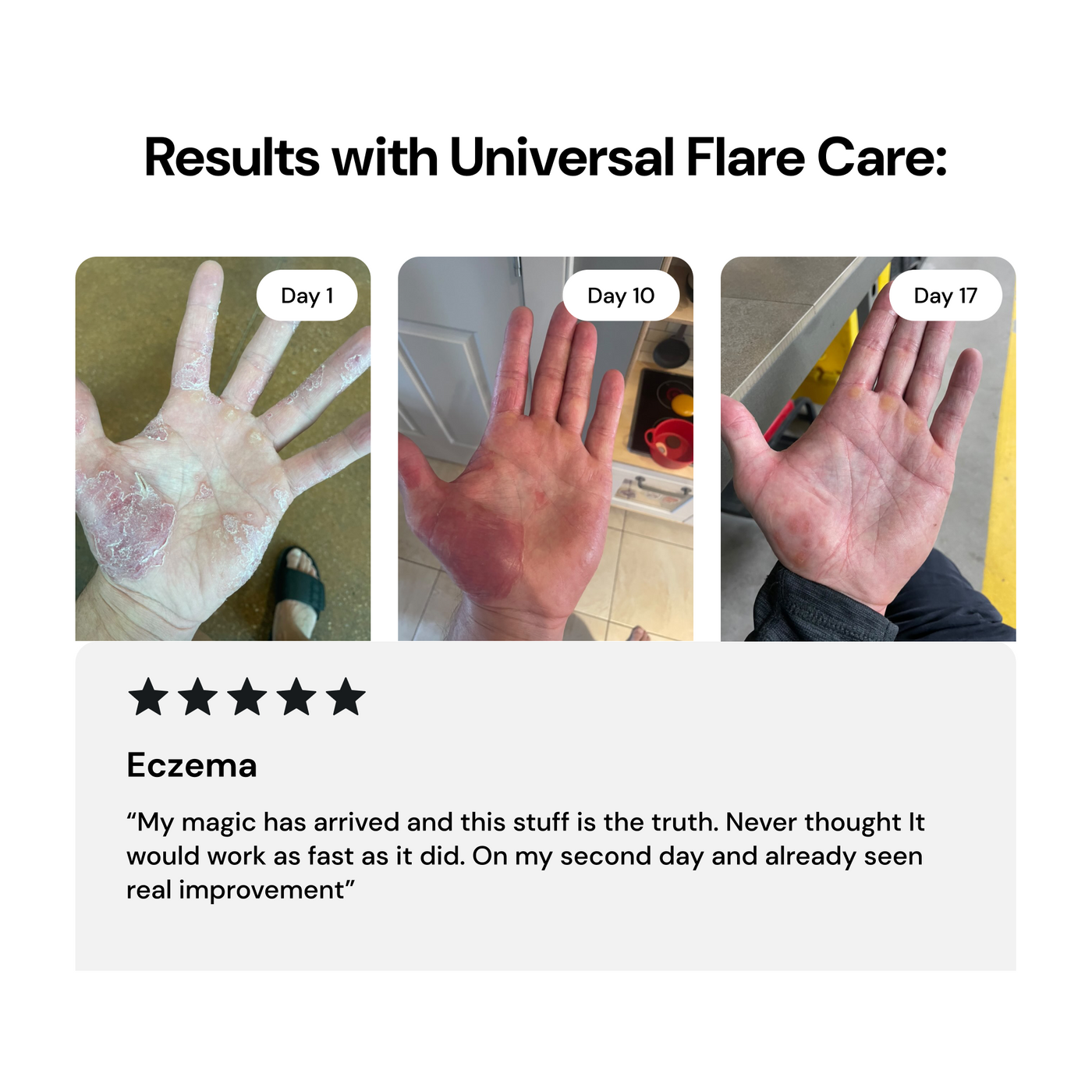 Universal Flare Care | Essential Oil Free