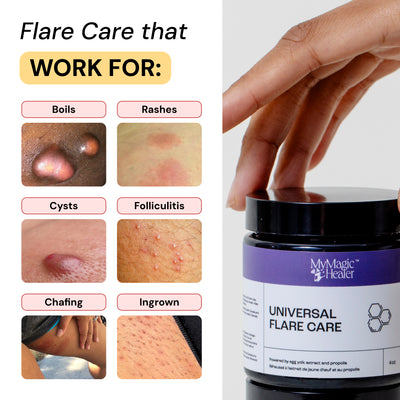 Universal Flare Care