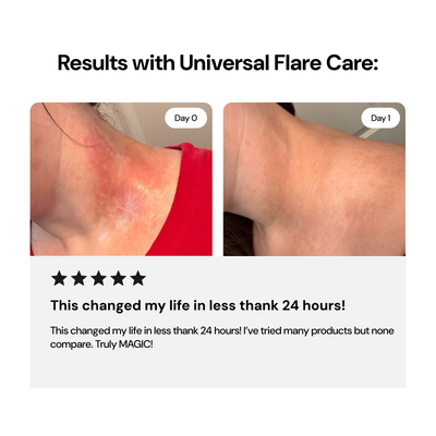 Universal Flare Care | Essential Oil Free