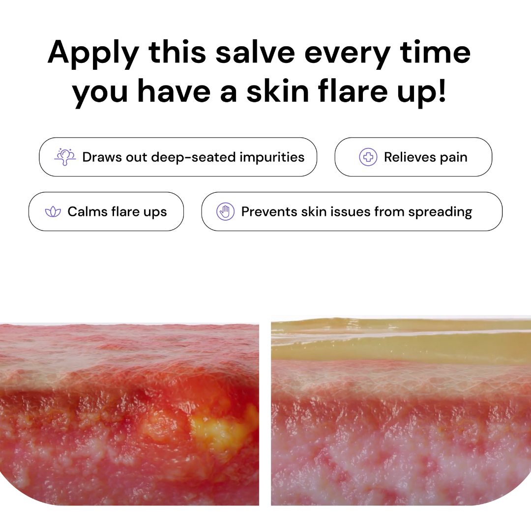 Beeswax & Propolis Magic Salve | Universal Skin Healer