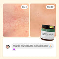 Flare Care Favorites Collection