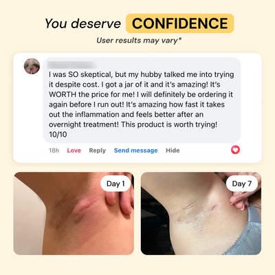 Universal Flare Care | Essential Oil Free