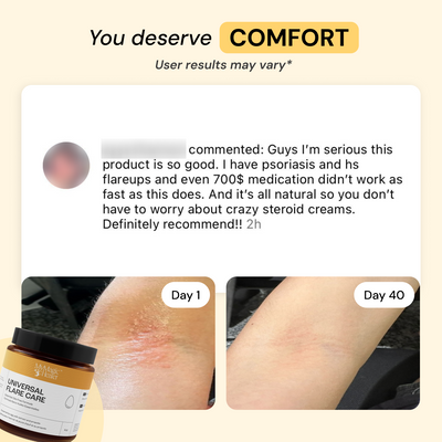 Flare Care Duo | 4oz