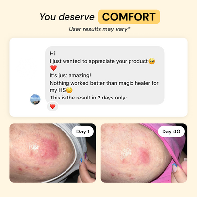 Universal Flare Care