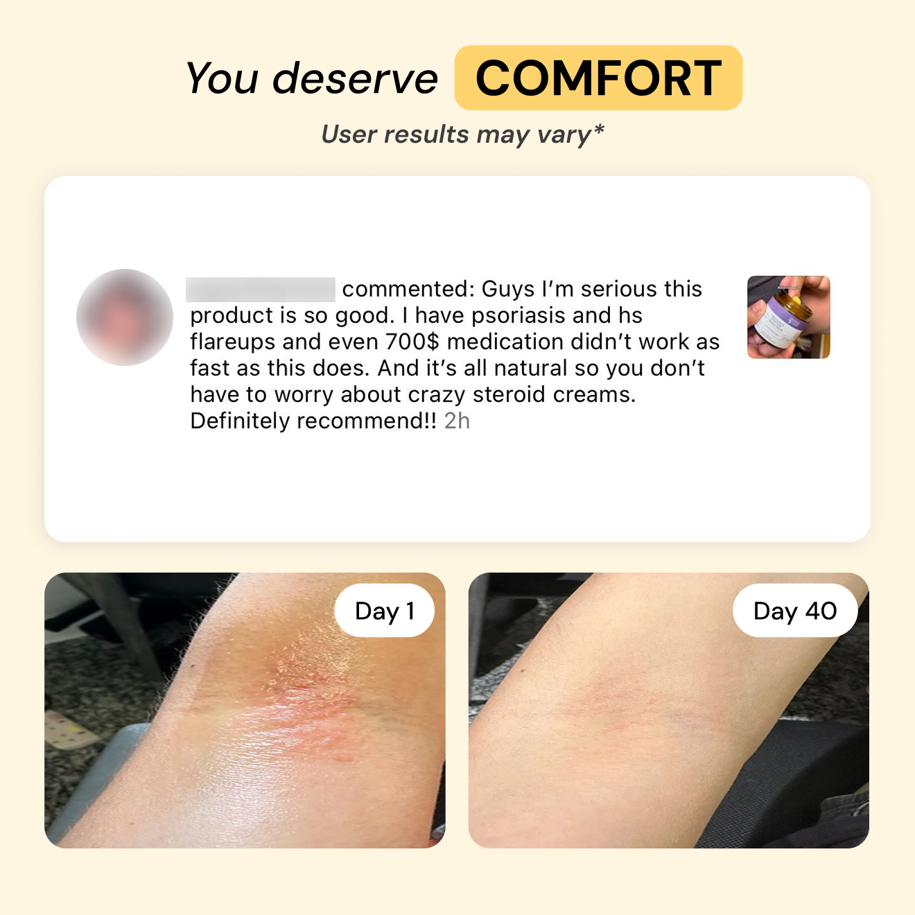 Universal Flare Care | Essential Oil Free