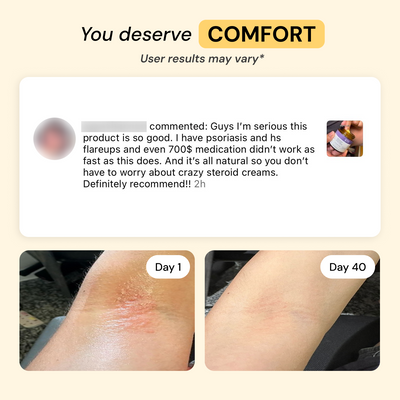 Universal Flare Care | Essential Oil Free