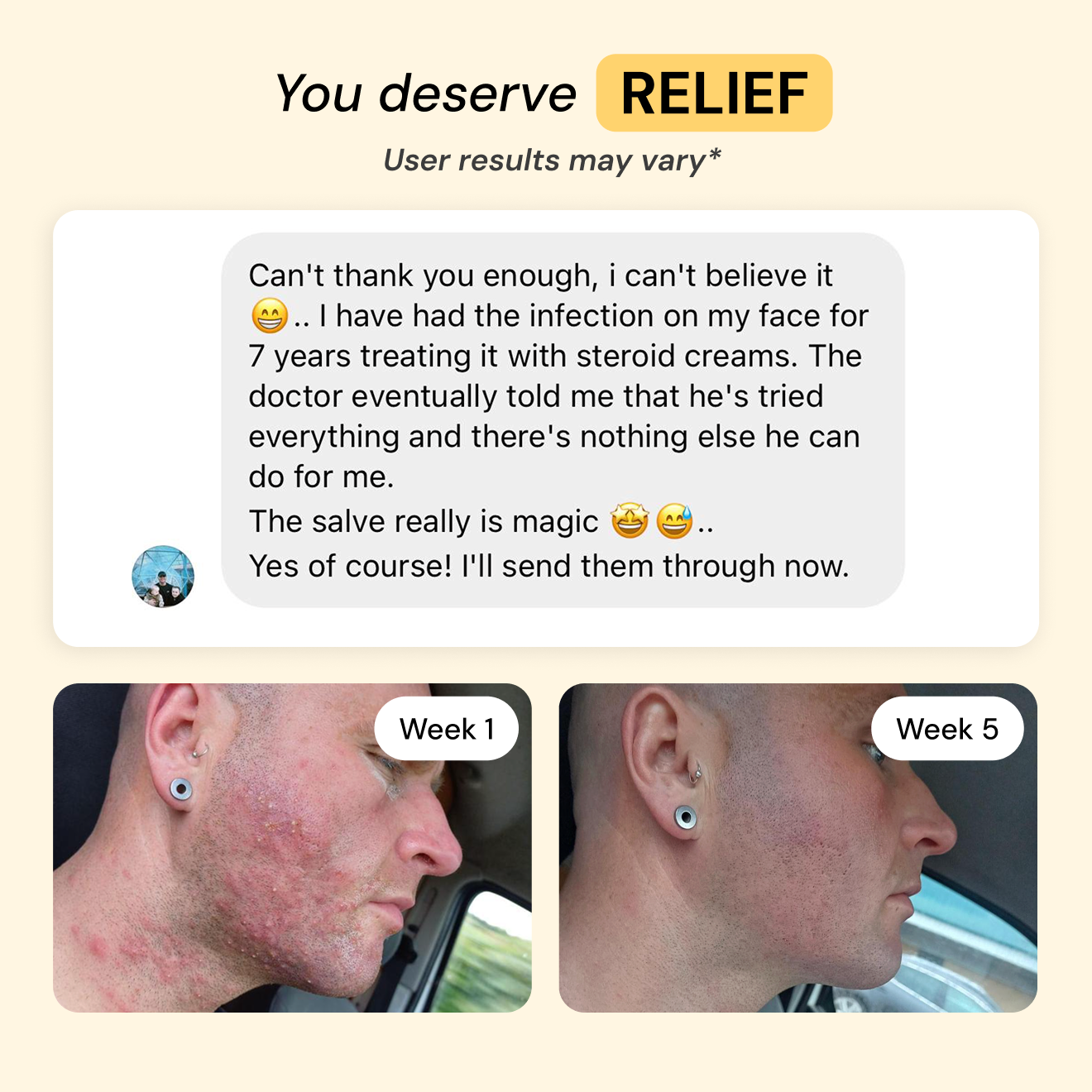 Thyme & Tea Tree Flare Care