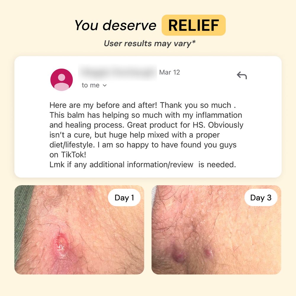 HS, Impetigo, Abscesses & Boils Solution | MyMagicHealer