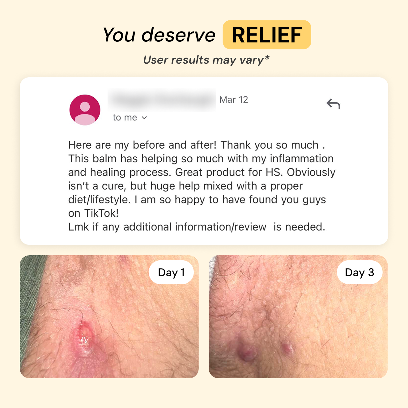 Universal Flare Care