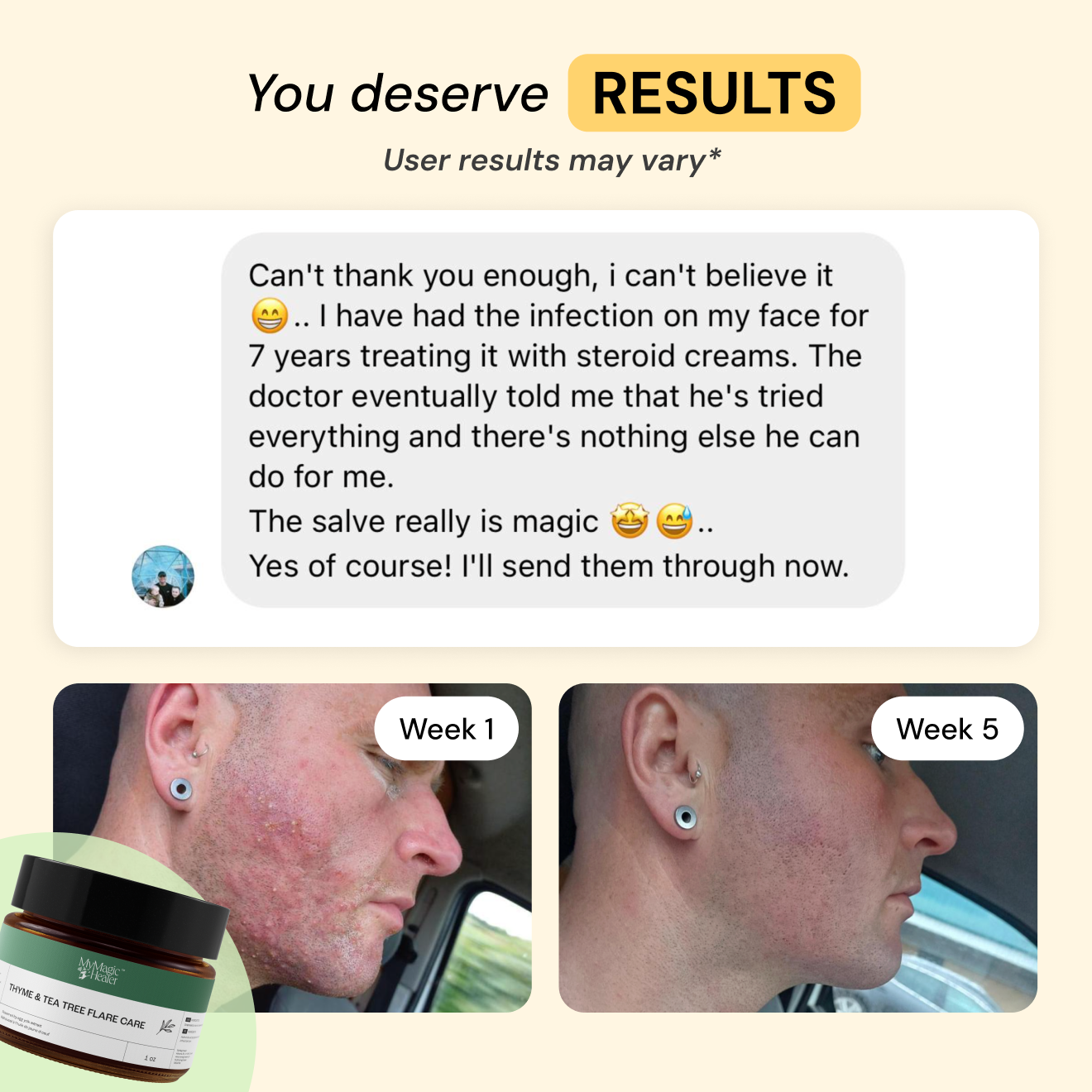 Comfort Flare Care Set