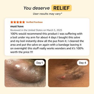 Universal Flare Care | Essential Oil Free