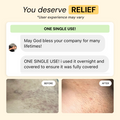 Folliculitis Flare Care Control