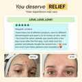 Folliculitis Flare Care Control