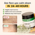 Folliculitis Flare Care Control