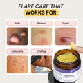 Best Flare Care Deal