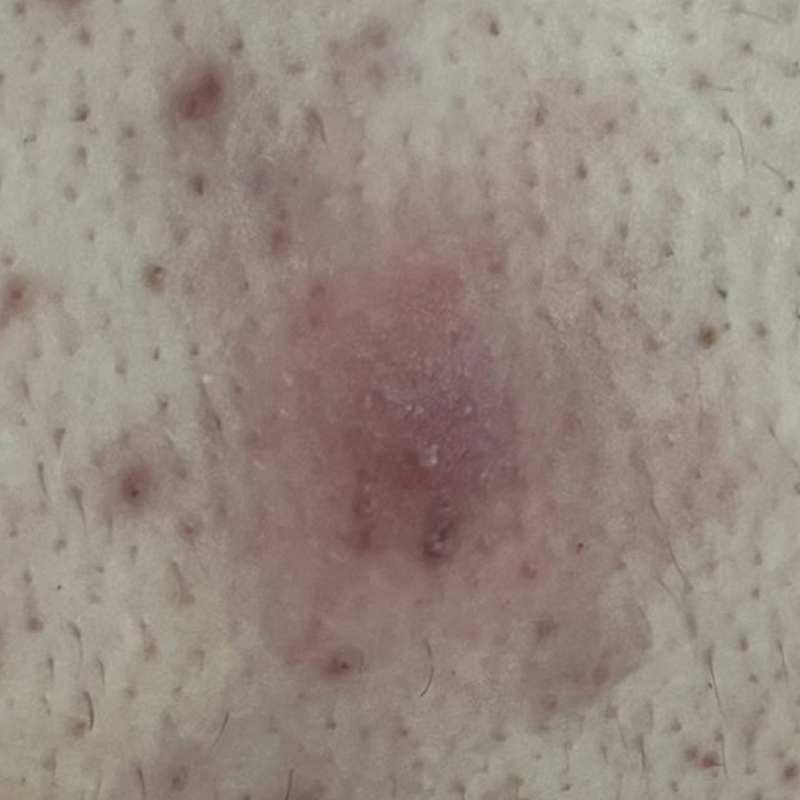 You notice bumps, roughness, or “something starting”