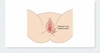 Adv Image