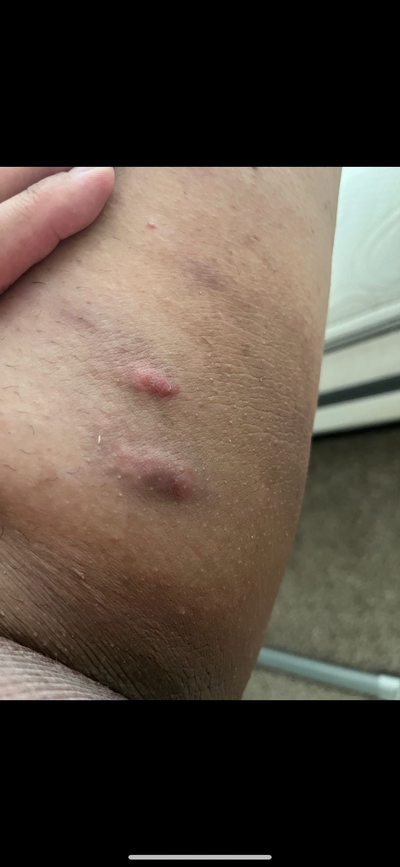 DAY 1