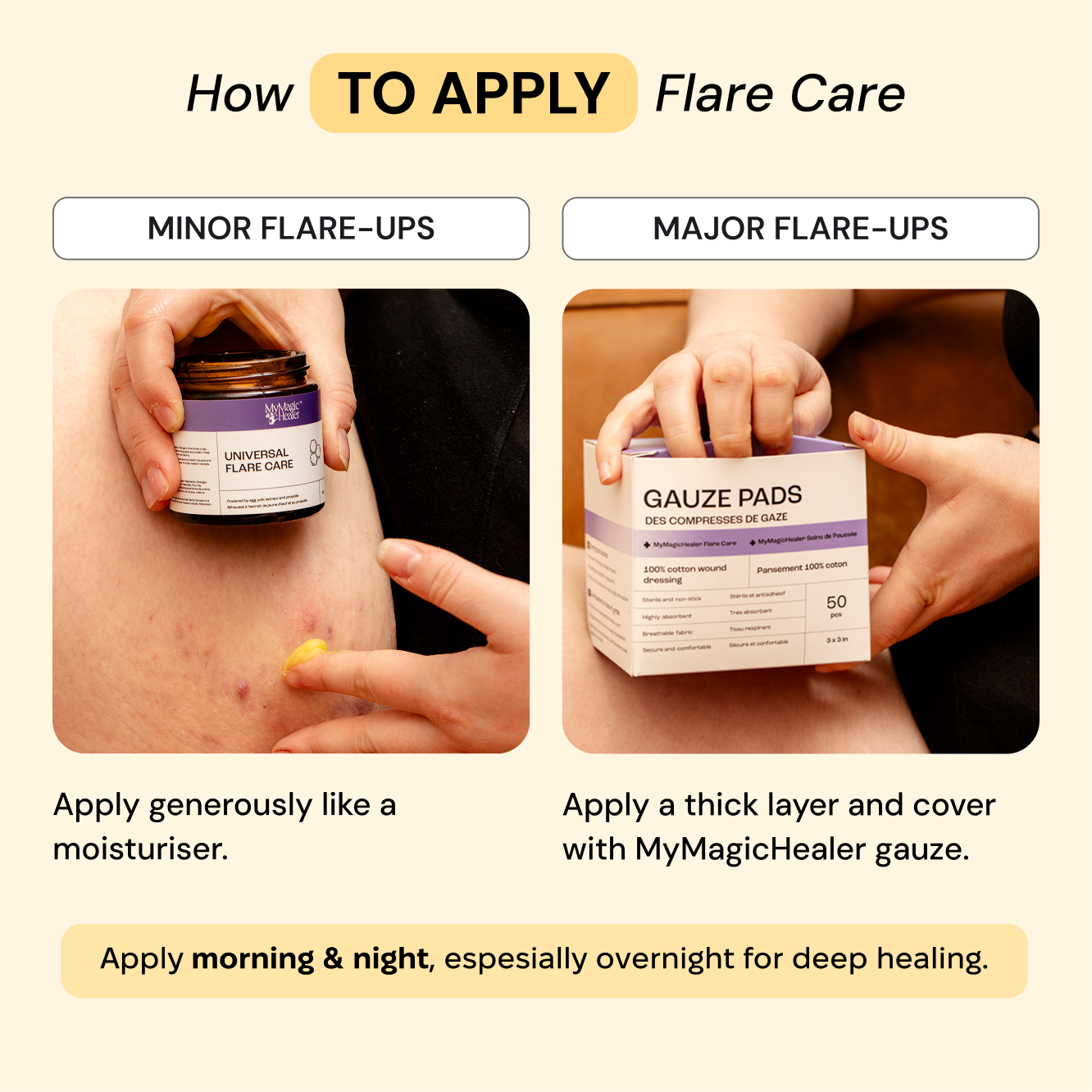 Universal Flare Care