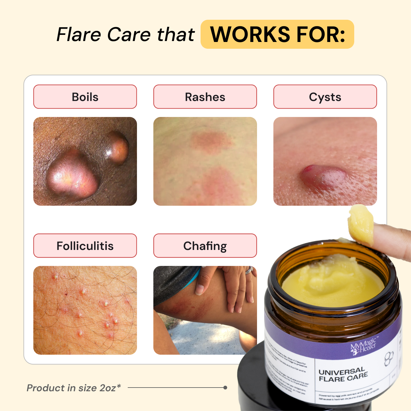Universal Flare Care