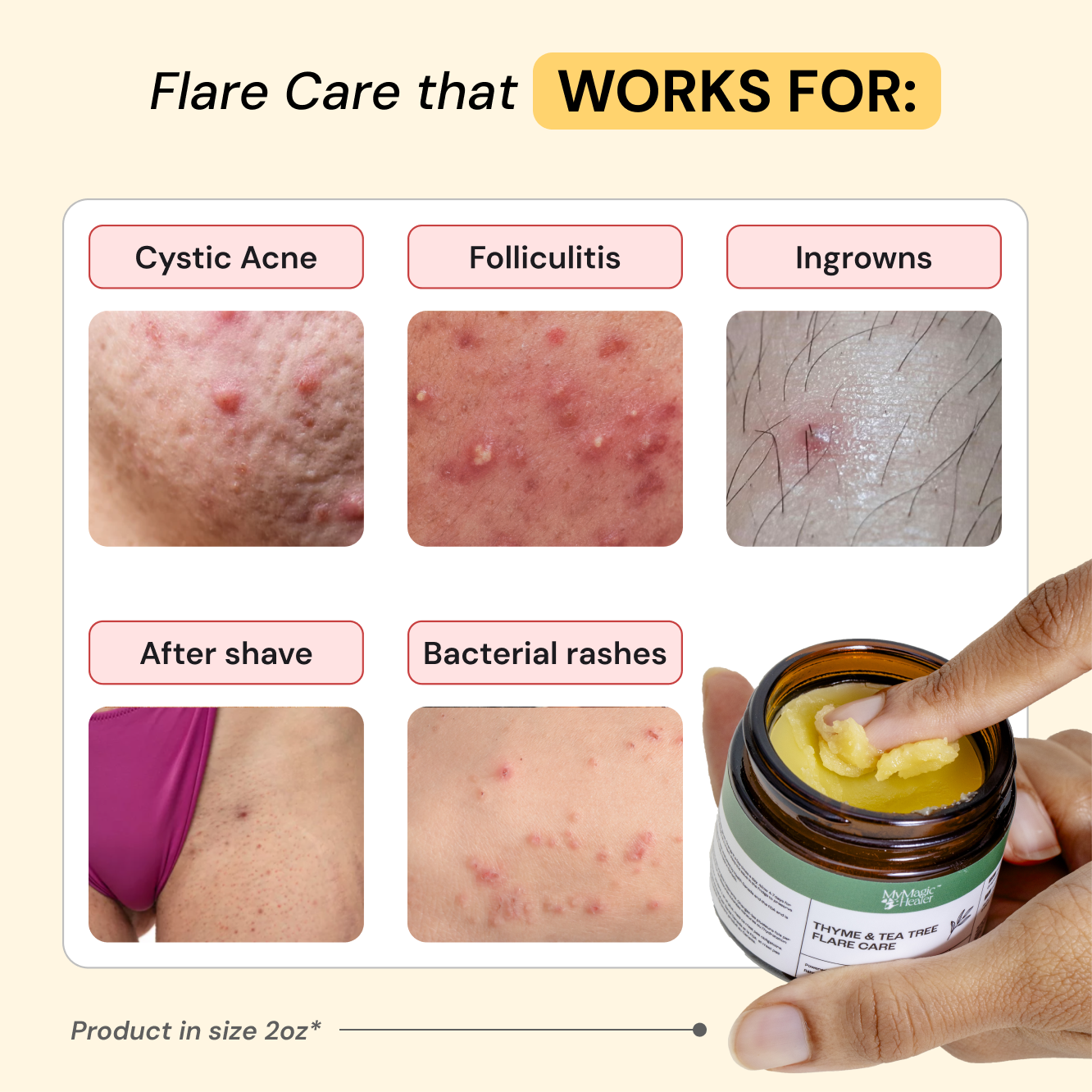 Thyme & Tea Tree Flare Care