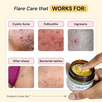Thyme & Tea Tree Flare Care