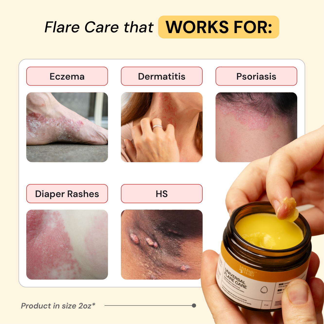 Universal Flare Care | Essential Oil Free