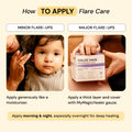 Universal Flare Care | Essential Oil Free