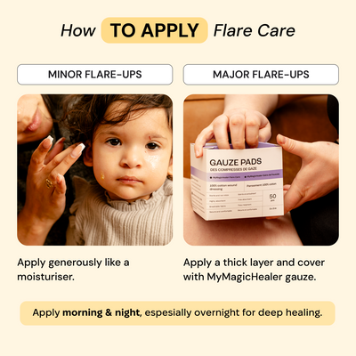 Universal Flare Care | Essential Oil Free