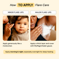 Universal Flare Care | Essential Oil Free