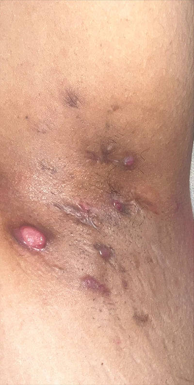 DAY 1