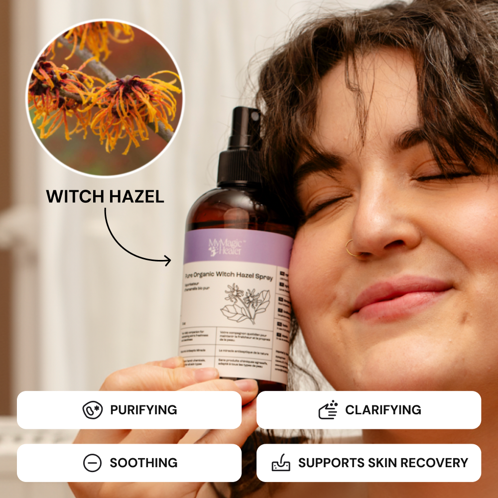 Boils, HS & Razor Bumps Witch Hazel Spray | MyMagicHealer Boils, HS & Razor Bumps Witch Hazel Spray | MyMagicHealer