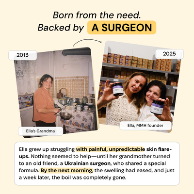 Universal Flare Care | Essential Oil Free