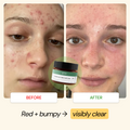 Active Lifestyle Flare Care