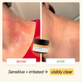 Active Lifestyle Flare Care