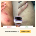 Active Lifestyle Flare Care